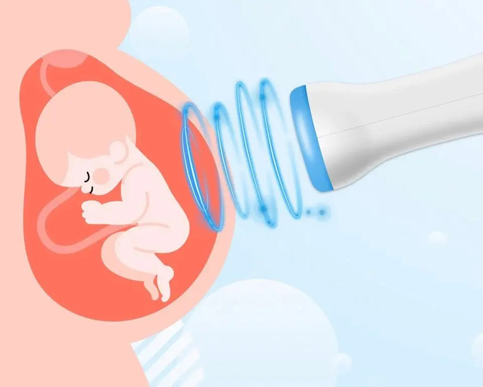 FETAL DOPPLER(BABY WATCHER) KUNI ULTRAZVUK ZA TRUDNICE FETAL DOPPLER(BABY WATCHER) KUNI ULTRAZVUK ZA TRUDNICE